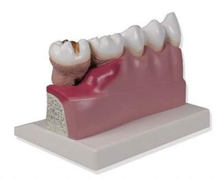 Schaumodell Dental Zahn Modell Zähne Zahnmodell Geschenk für den